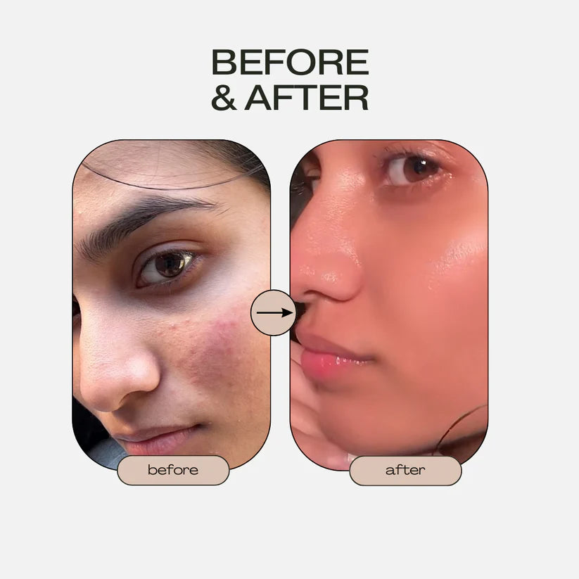 Aura Bounce Sheet Mask | Kindia Beauty